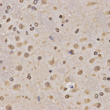 H3K36me1 Antibody
