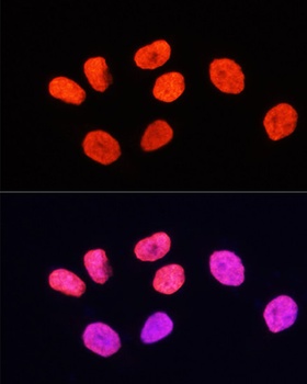 H3K27me3 Antibody