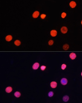 H3K27me3 Antibody