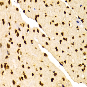 H3K27me2 Antibody