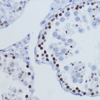 H3K9me3 Antibody