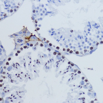 H3K9me3 Antibody