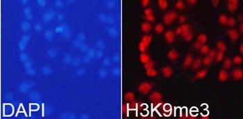 H3K9me3 Antibody