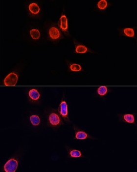 H3K9me1 Antibody