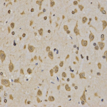 TriMethyl-Histone H3-K4 pAb