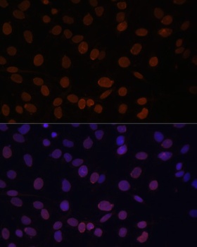 DiMethyl-Histone H3-K4 pAb