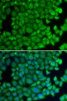 HSPB2 Antibody