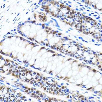 UHRF1 Antibody