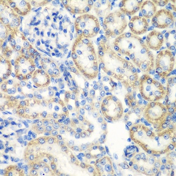 SMYD1 Antibody