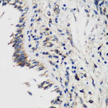 SMYD1 Antibody