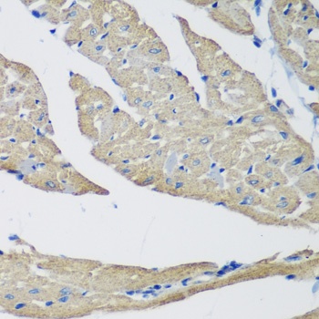 SMYD1 Antibody