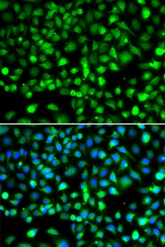 SMYD1 Antibody