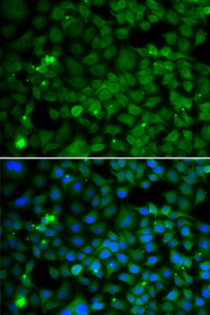 SMYD4 Antibody