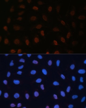 BRD4 Antibody