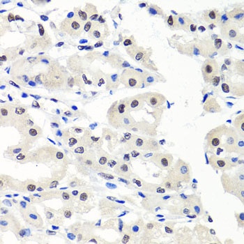 CBX1 Antibody