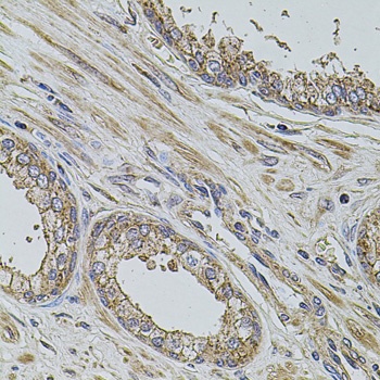 ALIX / PDCD6IP Antibody