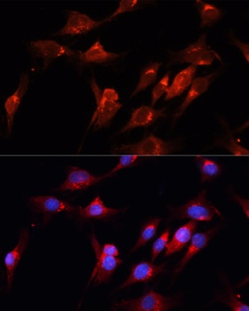 CUX1 Antibody