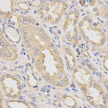 DCTN2 Antibody