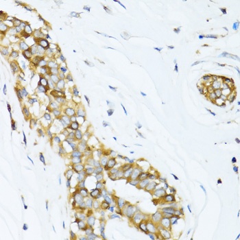 DCTN2 Antibody