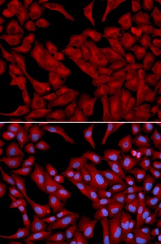 DCTN2 Antibody