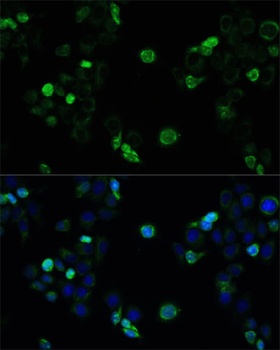 MRP4 / ABCC4 Antibody