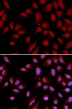 DLGAP5 Antibody