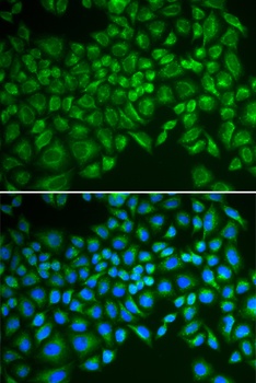 SELE Antibody