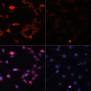 RPS6KB1 Antibody