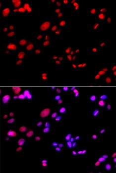 RPA2 Antibody