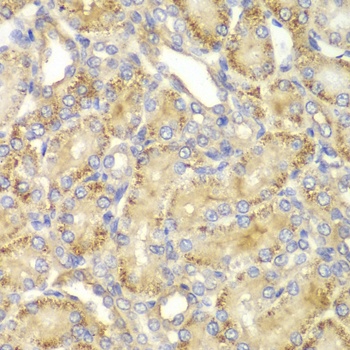 PPP2R2A Antibody