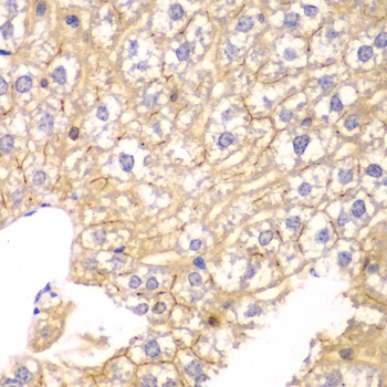 PPP2R2A Antibody