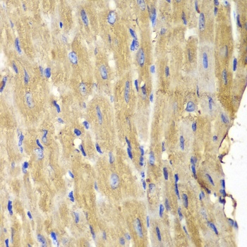 PLCG2 Antibody