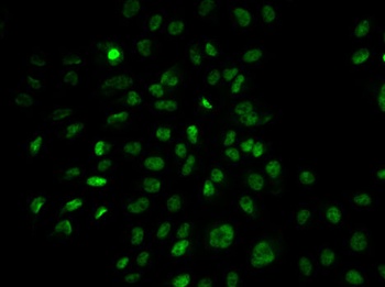 PLCG2 Antibody