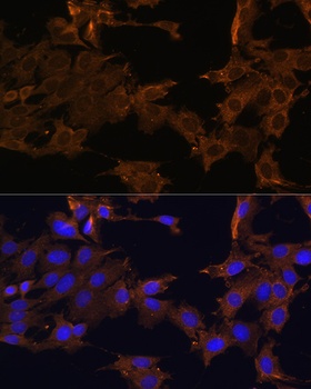 PDGFR beta Antibody