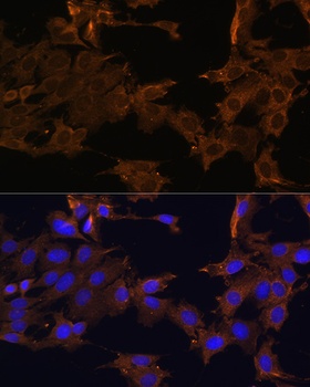 PDGFRB Antibody