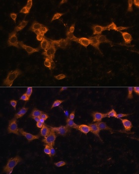 PDGFR beta Antibody