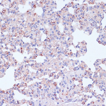 ITGB2 Antibody