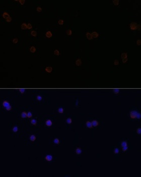 ITGB2 Antibody