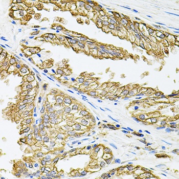 HLA-DQA1 Antibody