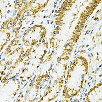 HLA-DQA1 Antibody
