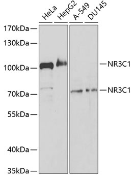 NR3C1 Antibody