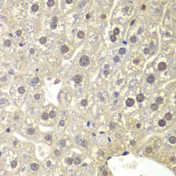 NR3C1 Antibody