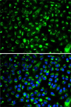 CYP2E1 Antibody