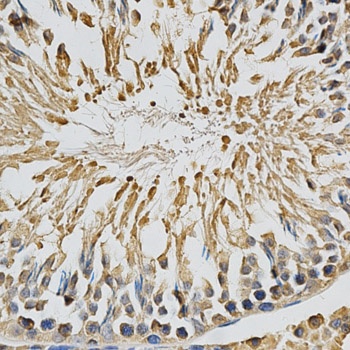 CYP1A1 Antibody