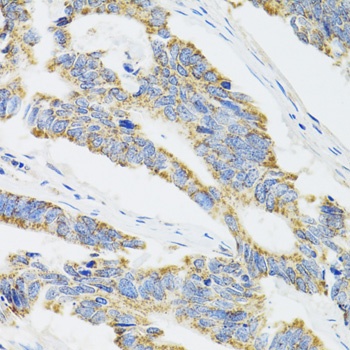 CYP1A1 Antibody