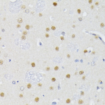 ATF2 Antibody