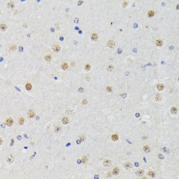 ATF2 Antibody