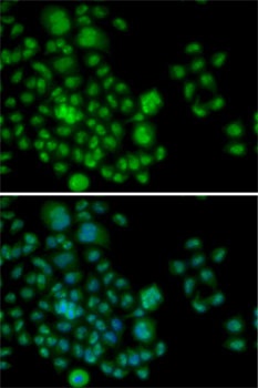 ATF2 Antibody