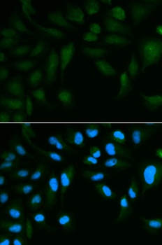 EPPIN Antibody