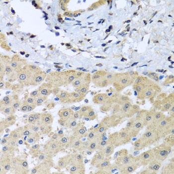 LETMD1 Antibody